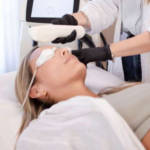 Luz pulsada y Láser para manchas